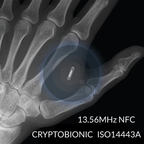 needle that rfid chip|are rfid implants safe.